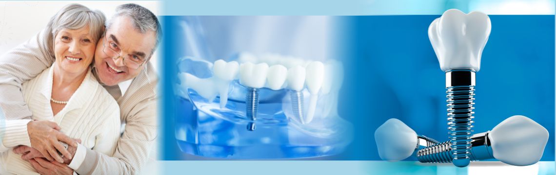 Implants Dental Clinic Bopal by best dentist in bopal to treat missing teeth