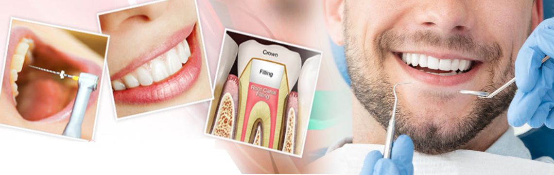 Treatment Dental Clinic Bopal Root Canal