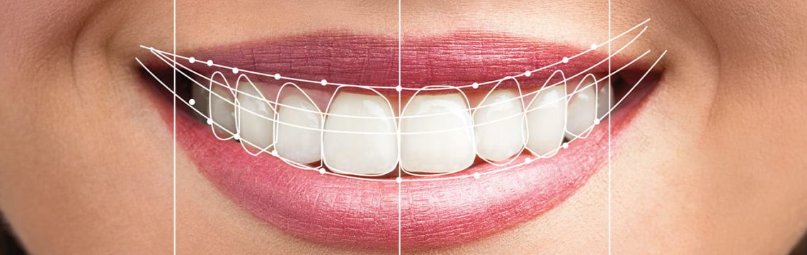 smile desing bopal by best dentist in bopal