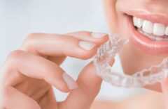 Aligner Dental Clinic Bopal for best irregular teeth treatment