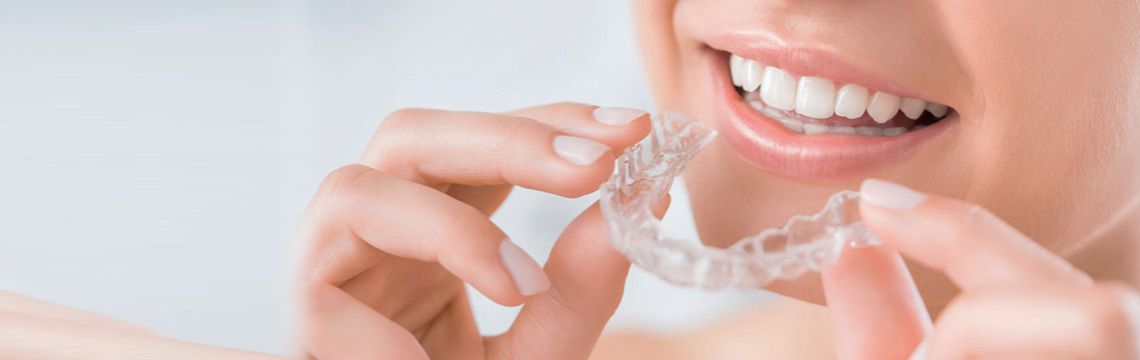 Aligner Dental Clinic Bopal for best irregular teeth treatment