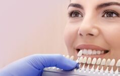 Veneers Dental Clinic Bopal for beautiful smile