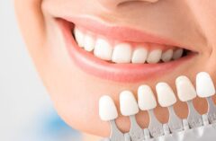 Teeth Whitening Dental Clinic bopal for bright smile to impress everybody